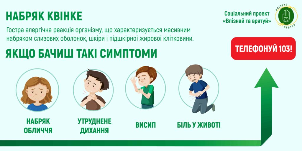 nabryak kvinke vpiznaj ta vryatuj